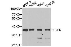 Image no. 2 for anti-E2F Transcription Factor 6 (E2F6) antibody (ABIN6570272)