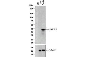 Image no. 1 for anti-Transcription Termination Factor, RNA Polymerase I (TTF1) (AA 201-300) antibody (ABIN728713)