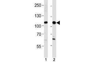Image no. 1 for anti-Sal-Like 4 (SALL4) (AA 1009-1039) antibody (ABIN3028999)