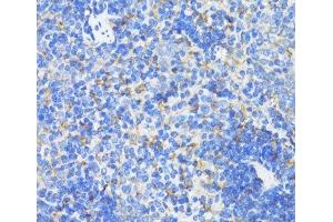 Immunohistochemistry of paraffin-embedded Mouse spleen using SDHB Polyclonal Antibody at dilution of 1:100 (40x lens).