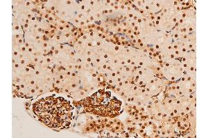 Image no. 7 for anti-Jun Proto-Oncogene (JUN) (pThr91) antibody (ABIN6256604)