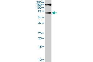 Image no. 2 for anti-Tyrosinase (TYR) (AA 1-377) antibody (ABIN521194)