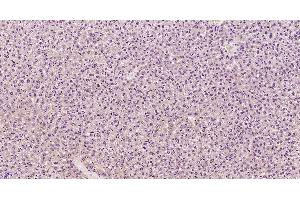 Image no. 2 for anti-Complement Component C9b (C9b) (AA 251-350) antibody (ABIN1714714)