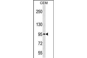 Image no. 1 for anti-Adrenergic, Beta, Receptor Kinase 2 (ADRBK2) (AA 524-552), (C-Term) antibody (ABIN5530602)