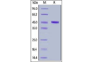 Image no. 1 for Cbl Proto-Oncogene B, E3 Ubiquitin Protein Ligase (CBLB) (AA 39-426) protein (His tag) (ABIN6938865)