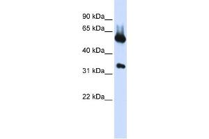 Image no. 1 for anti-Aminolevulinate, delta-, Synthase 2 (ALAS2) (N-Term) antibody (ABIN2776923)