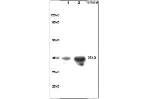 Image no. 4 for anti-Coagulation Factor III (thromboplastin, Tissue Factor) (F3) (AA 32-100) antibody (ABIN708086)