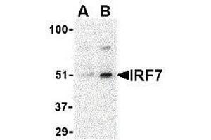 Image no. 1 for anti-Interferon Regulatory Factor 7 (IRF7) (Center) antibody (ABIN2475145)