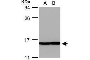 Image no. 2 for anti-Profilin 2 (PFN2) (Center) antibody (ABIN2856620)