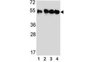 Image no. 2 for anti-Tubulin, beta 2C (TUBB2C) (AA 99-125) antibody (ABIN3029344)