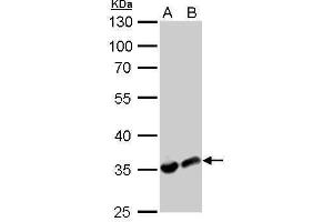 Image no. 7 for anti-Lactate Dehydrogenase A (LDHA) (Center) antibody (ABIN2855034)