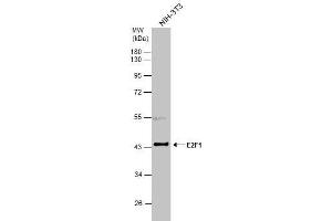 Image no. 1 for anti-E2F Transcription Factor 1 (E2F1) (Center) antibody (ABIN2854981)