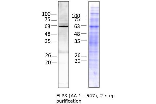 ELP3/KAT9 Protein (AA 1-547) (His tag)