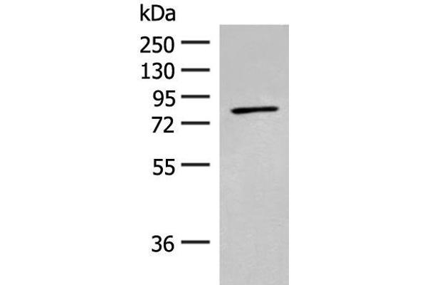 ADAM21 anticorps