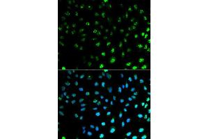 Image no. 1 for anti-S100 Calcium Binding Protein A8 (S100A8) (pSer100) antibody (ABIN3022396)