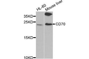 Image no. 2 for anti-CD70 Molecule (CD70) antibody (ABIN3022743)