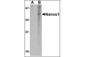 Western blot analysis of Nanos1 in SK-N-SH cell lysate with this product at 1 μg/ml in (A) the presence and (B) the absence of blocking peptide.