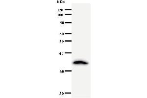 CRNKL1 antibody