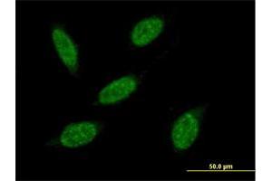 Image no. 1 for anti-Ring Finger Protein 20 (RNF20) (AA 1-975) antibody (ABIN1327712)