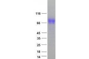Image no. 1 for Tyrosinase (TYR) protein (Myc-DYKDDDDK Tag) (ABIN2734714)