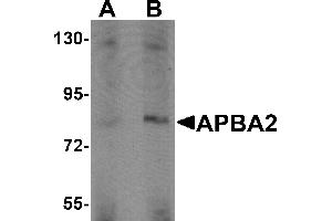 Image no. 2 for anti-Amyloid beta (A4) Precursor Protein-Binding, Family A, Member 2 (APBA2) (Middle Region) antibody (ABIN1030857)