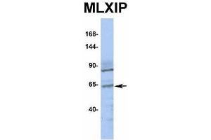 Image no. 4 for anti-MLX Interacting Protein (MLXIP) (Middle Region) antibody (ABIN2776519)