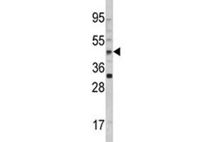 Image no. 1 for anti-Arylacetamide Deacetylase (Esterase) (AADAC) (AA 273-300) antibody (ABIN5647317)