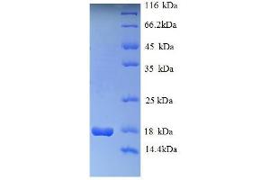 Image no. 1 for Histone Cluster 1, H2ag (HIST1H2AG) (AA 2-130) protein (His tag) (ABIN5709657)