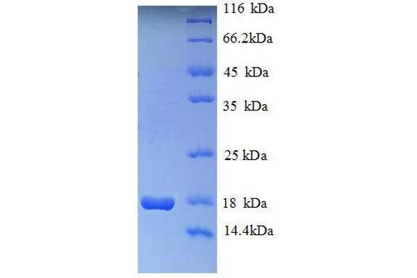 HIST1H2AG Protein (AA 2-130) (His tag)