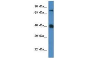 Image no. 1 for anti-Solute Carrier Family 7 (Cationic Amino Acid Transporter, Y+ System), Member 3 (SLC7A3) (AA 130-179) antibody (ABIN6746228)
