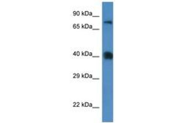 SLC7A3 anticorps  (AA 130-179)