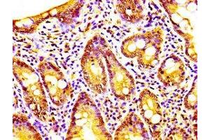 Caprin-1 antibody  (AA 573-703)