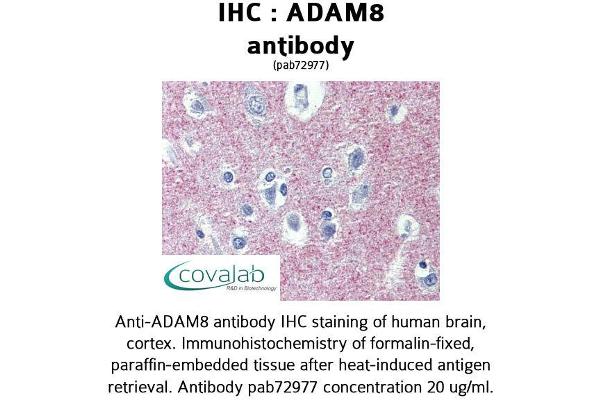 ADAM8 抗体  (AA 763-824)