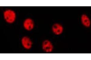 Image no. 1 for anti-Torsin A Interacting Protein 1 (TOR1AIP1) antibody (ABIN6259291)