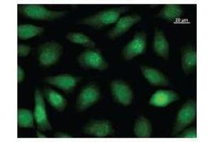 Image no. 2 for anti-Nuclear Factor I/B (NFIB) antibody (ABIN930910)