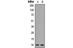 Image no. 1 for anti-Transition Protein 2 (During Histone To Protamine Replacement) (TNP2) (C-Term) antibody (ABIN2705301)