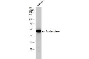 Image no. 1 for anti-Creatine Kinase, Brain (CKB) (Center) antibody (ABIN2855158)