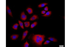 Image no. 3 for anti-Nuclear Factor of kappa Light Polypeptide Gene Enhancer in B-Cells 2 (NFKB2) (AA 151-250) antibody (ABIN1386117)