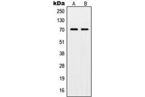 Image no. 1 for anti-Protection of Telomeres 1 (POT1) (Center) antibody (ABIN2706853)