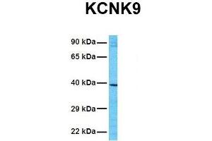 Image no. 6 for anti-Potassium Channel, Subfamily K, Member 9 (KCNK9) (N-Term) antibody (ABIN2776216)