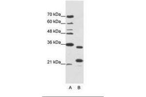 Image no. 1 for anti-AlkB, Alkylation Repair Homolog 8 (ALKBH8) (AA 141-190) antibody (ABIN1099945)