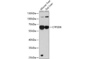Western blot analysis of extracts of various cell lines, using CYP2D6 antibody (ABIN1512811, ABIN3021880, ABIN3021882 and ABIN6216807) at 1:1000 dilution.