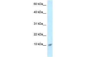 Image no. 1 for anti-S100 Calcium Binding Protein A8 (S100A8) (Middle Region) antibody (ABIN2788781)