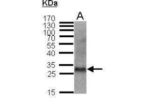 Image no. 2 for anti-Cyclin-Dependent Kinase Inhibitor 1B (p27, Kip1) (CDKN1B) (Center) antibody (ABIN2854753)