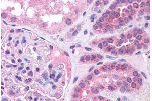 Image no. 1 for anti-V-Maf Musculoaponeurotic Fibrosarcoma Oncogene Homolog (Avian) (MAF) (N-Term) antibody (ABIN6745717)