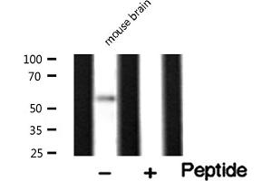 Image no. 4 for anti-Peripherin (PRPH) antibody (ABIN6264142)