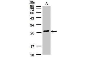 Image no. 3 for anti-Glutathione S-Transferase alpha 2 (GSTa2) (Center) antibody (ABIN2856132)