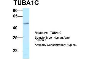 Image no. 1 for anti-Tubulin, alpha 1c (TUBA1C) (C-Term) antibody (ABIN2788513)