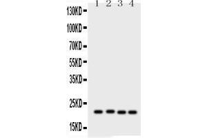 Image no. 1 for anti-Suppressor of Cytokine Signaling 2 (SOCS2) (AA 96-198) antibody (ABIN3042487)