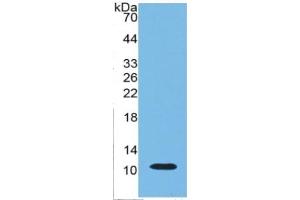 Image no. 2 for Indoleamine 2,3-Dioxygenase (IDO) ELISA Kit (ABIN6730945)
